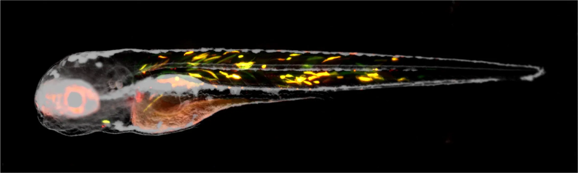 Fluorescently labelled individual muscle fibres in a zebrafish larva.