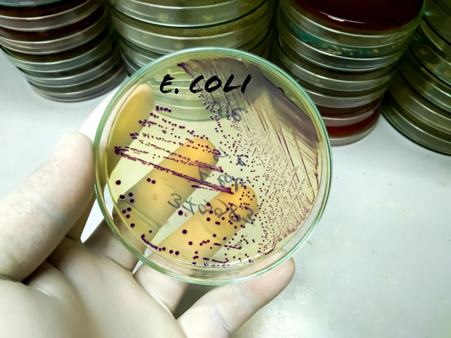 Identifying Key Genetic Elements for Plasmid Curing in E. coli
