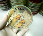 Identifying Key Genetic Elements for Plasmid Curing in E. coli