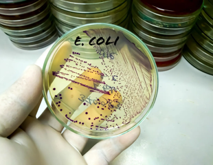 Identifying Key Genetic Elements for Plasmid Curing in E. coli