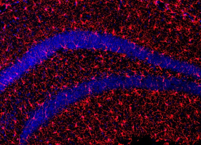 Microscopic image of microglial cells (part of the brain