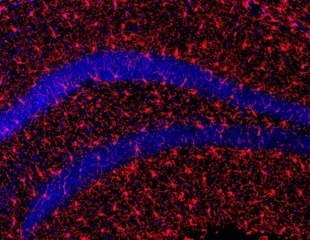 Novel Therapeutic Strategy for Healthy Aging and Longevity