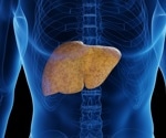 Depleting TM6SF2 in the Gut Worsens Liver Fat Buildup, Study Finds