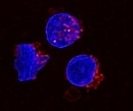 Lipid-Rich Ascites Weakens Immunity in Advanced Ovarian Cancer