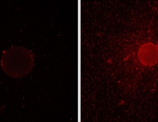 Unraveling the Genetic Basis of Biosurfactant Production in an Oil-Degrading Bacterium