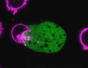 Unraveling How E. histolytica Kills Cells and Evades the Immune System