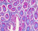 Addressing Protein Leakage in Cells to Improve the Accuracy of Single-Cell Proteomic Data