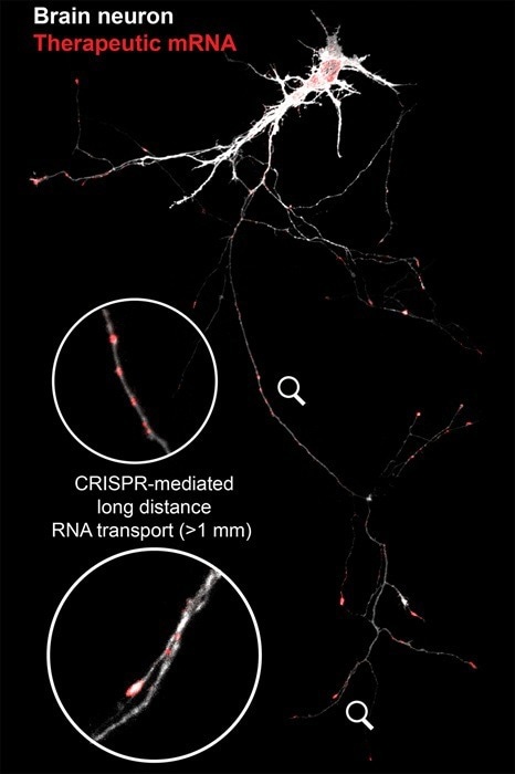 New “Zip Code” Technology for Precise RNA Delivery in Neurons