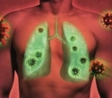 Study Reveals Genetic Predisposition to Long COVID Near Lung-Related Gene