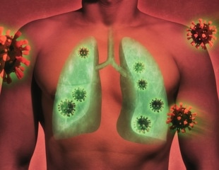 Study Reveals Genetic Predisposition to Long COVID Near Lung-Related Gene