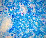Reversible DNA Modification Controls Replication and Gene Activity