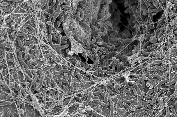 Uncovering How Cholera Evaded Phages For Epidemic Success