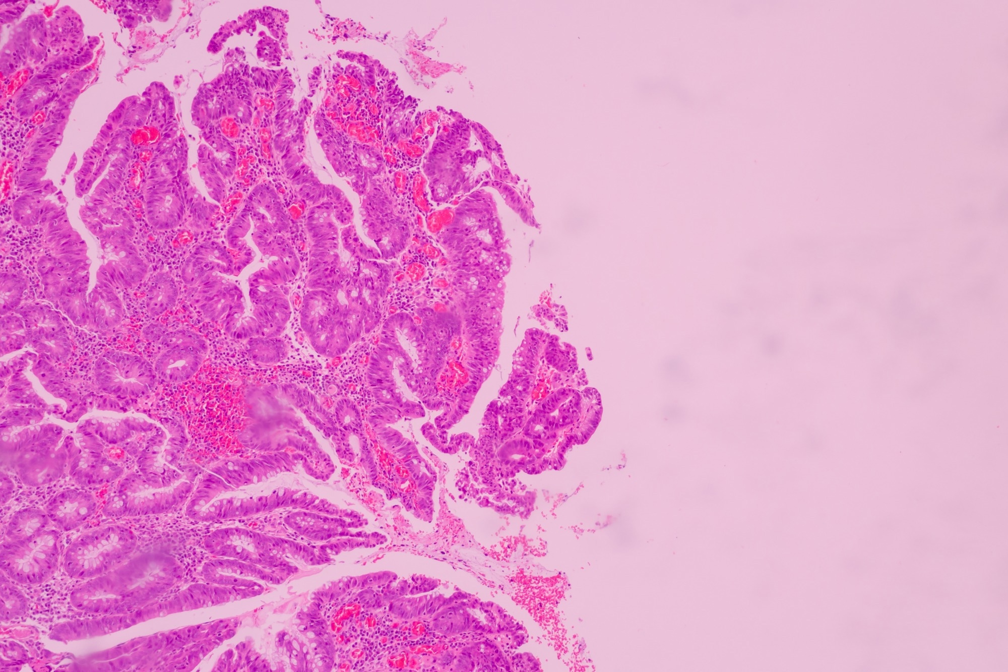 Backgrounds of human cells tissue of lung human under the microscope in pathology lab.