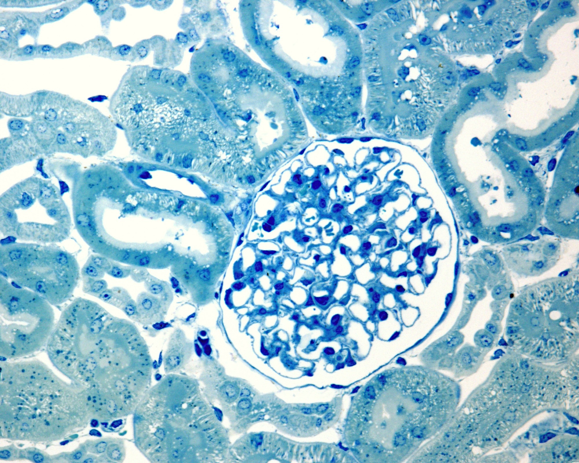 Glomerulus surrounded by convoluted tubules. The capillary loops, podocytes, Bowman