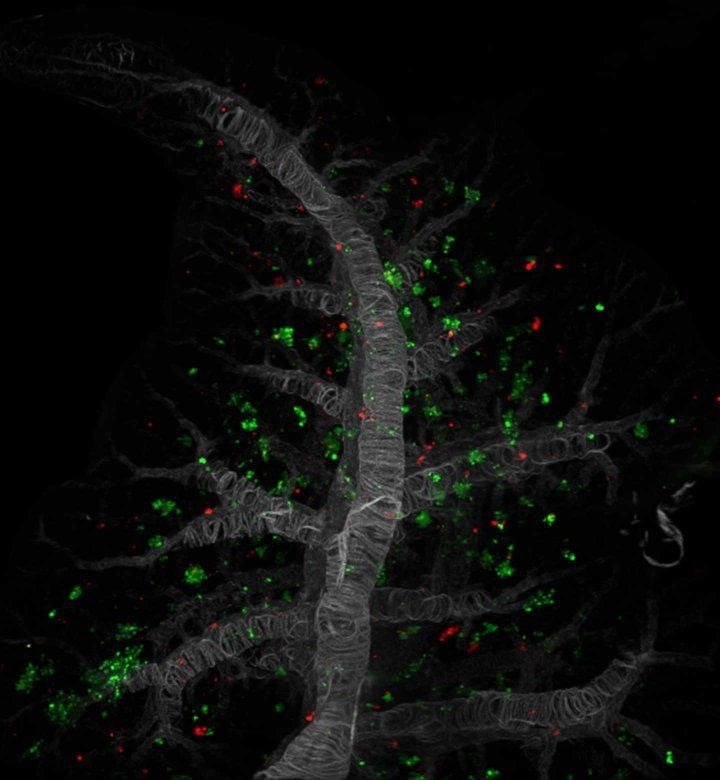 Key Factor in Pancreatic Cancer Cell Survival in Distinct Environments