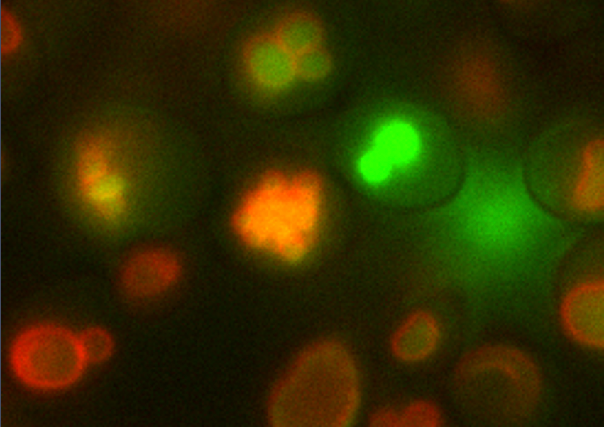 Genetically Modified Yeast Turns Urine into Bone Material