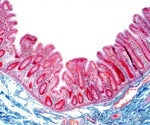 Organotypic Model of the Human Gut Epithelium Demonstrates Genetic Determinants of Shigella Colonization