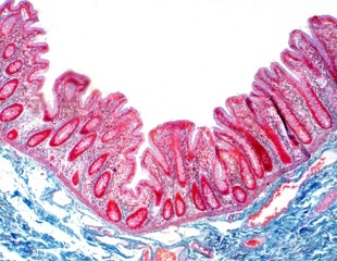 Organotypic Model of the Human Gut Epithelium Demonstrates Genetic Determinants of Shigella Colonization