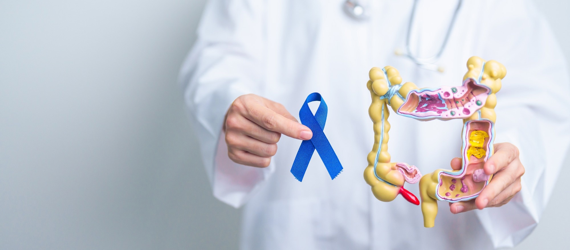 Doctor holding Blue ribbon with human Colon anatomy model.