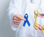 Do Genetic Variants That Affect DNA Methylation Influence Colorectal Cancer Risk or Outcomes?