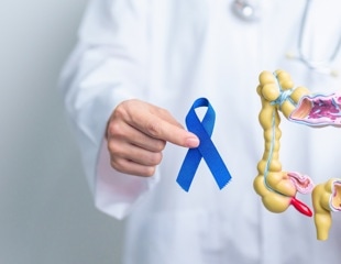 Do Genetic Variants That Affect DNA Methylation Influence Colorectal Cancer Risk or Outcomes?