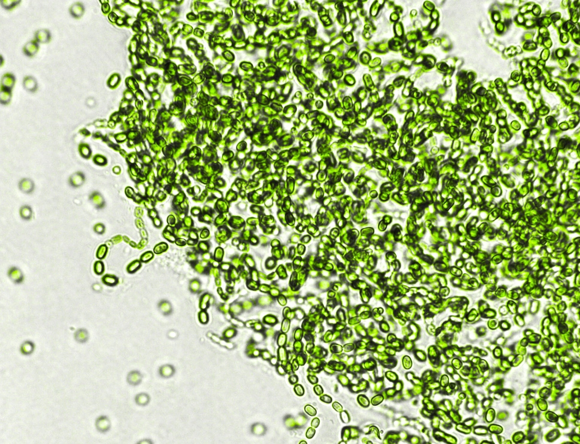 Bacteria under a microscope.