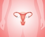 Cell Adhesion Mechanisms Behind Endometriosis Spread
