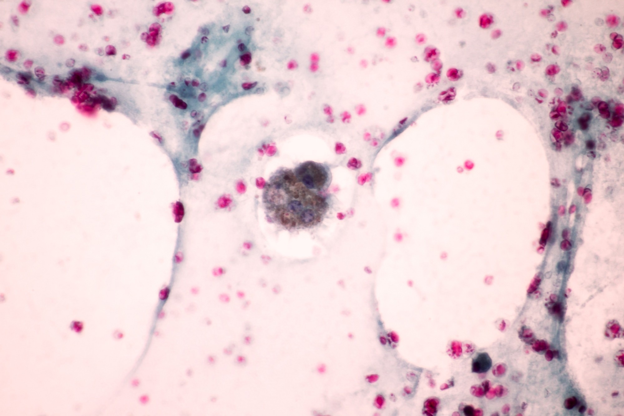 View in microscopic of macrophages from human body