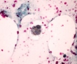 Animal-Free 3D Fat-Immune Cell Model to Study Inflammation