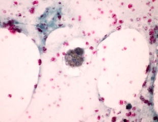 Animal-Free 3D Fat-Immune Cell Model to Study Inflammation
