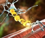 OHSU Team Identifies Gene Essential for Brain's Protective Layer