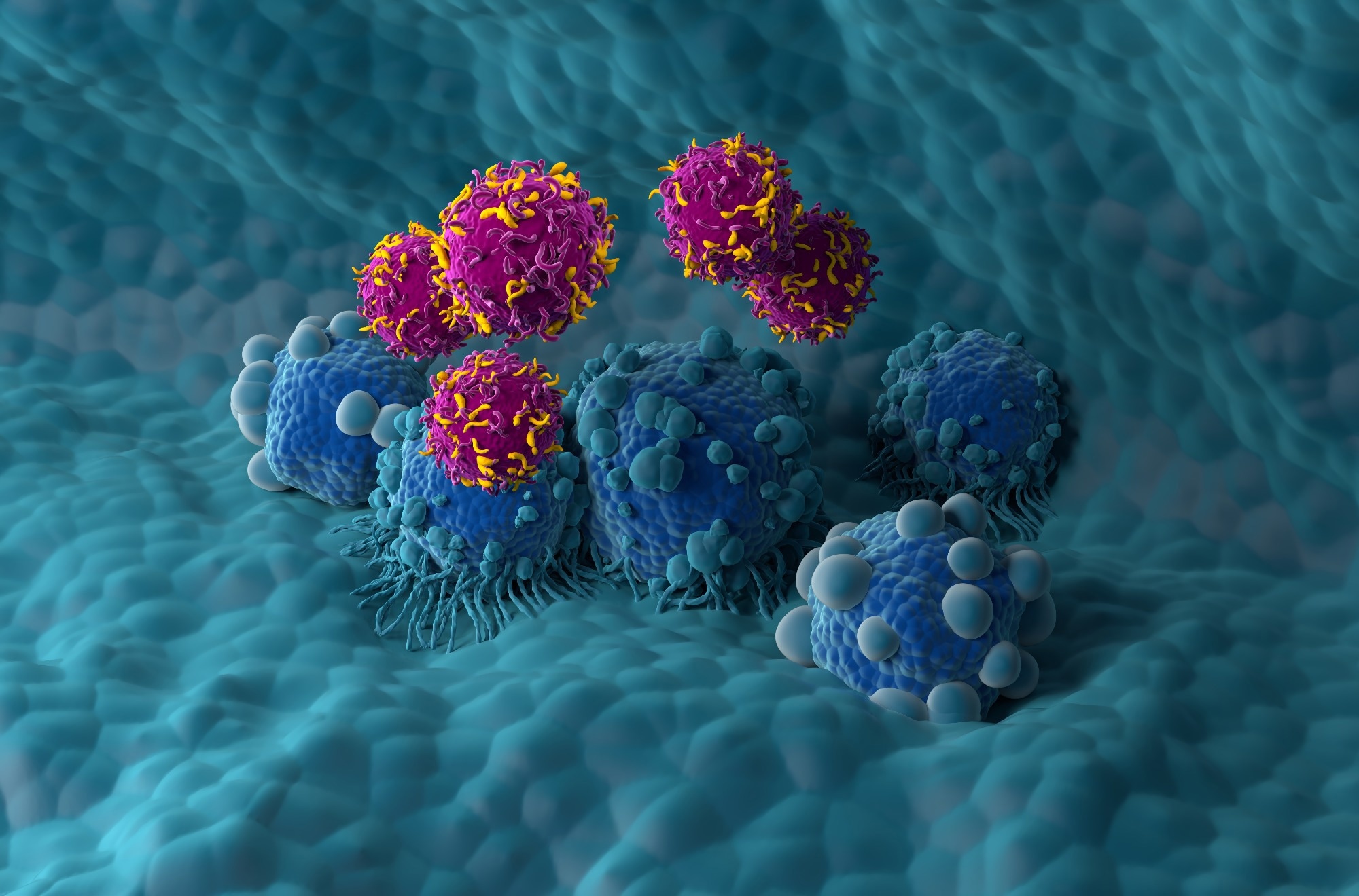 CAR T cell therapy in Pancreatic cancer