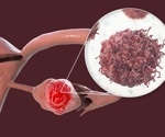 Blocking TG2 Could Help Immune Cells Attack Ovarian Tumors