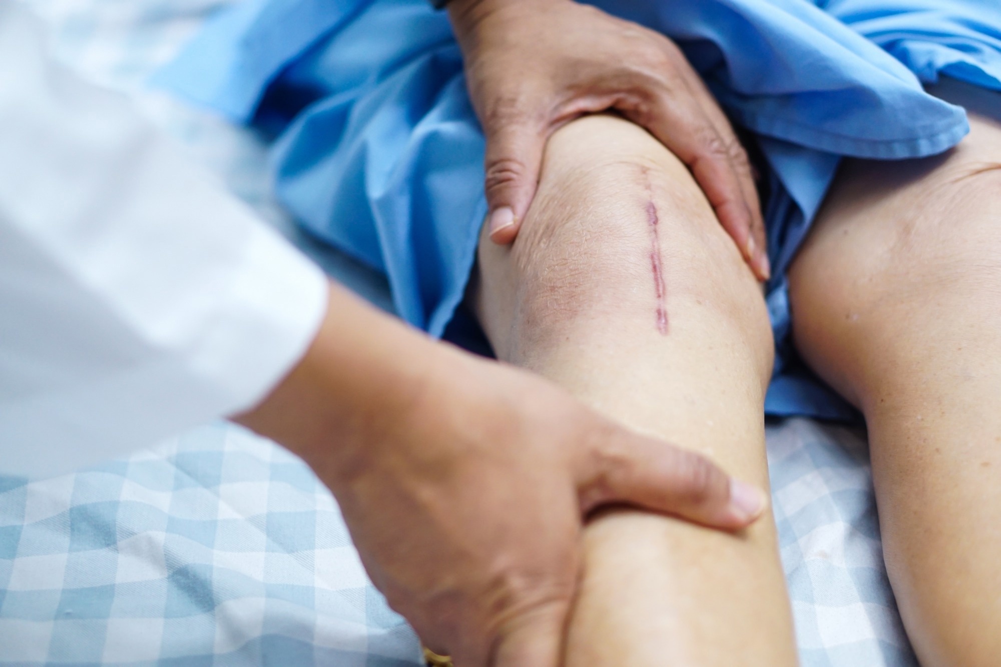 Doctor check Asian senior or elderly old lady woman patient scars