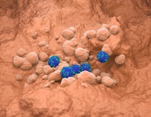 CD276 Antibody Strategy Offers Hope For Immune-Resistant Lung Tumors