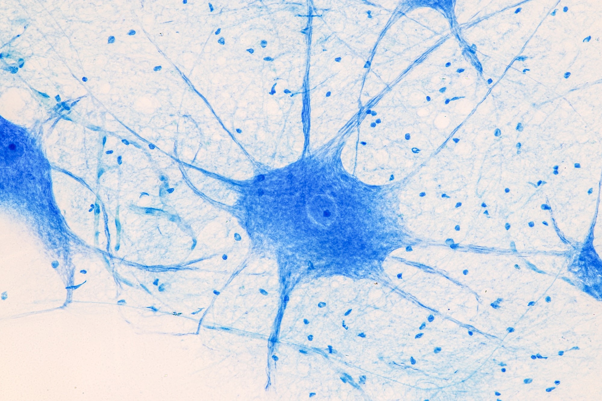Motor Neuron under the microscope in Lab
