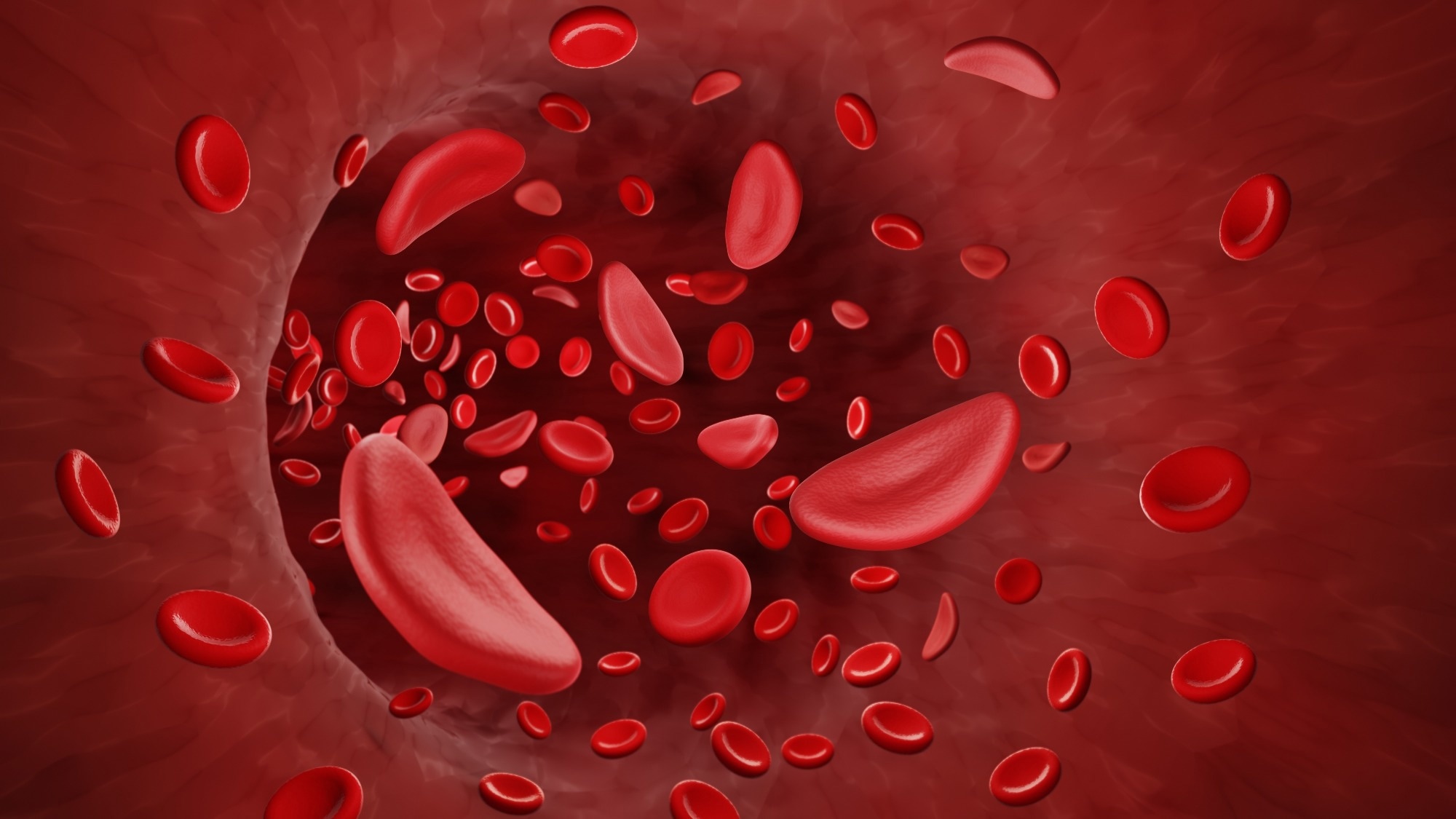 Normal red blood cell and sickle cell flow inside in artery.