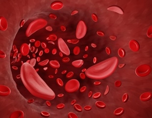 New Gene Silencers Offer Hope for Hereditary Blood Disorders