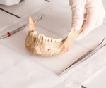 How Newly Discovered Teeth In Ethiopia Are Changing The Human Origin Story