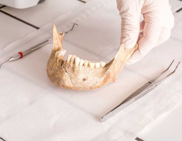How Newly Discovered Teeth In Ethiopia Are Changing The Human Origin Story