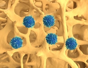 New Research Highlights a More Efficient CAR T Treatment
