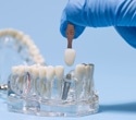 Built Oral Biofilm Models Reveal How Peri-Implantitis Develops
