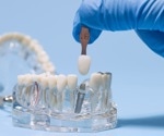 Built Oral Biofilm Models Reveal How Peri-Implantitis Develops