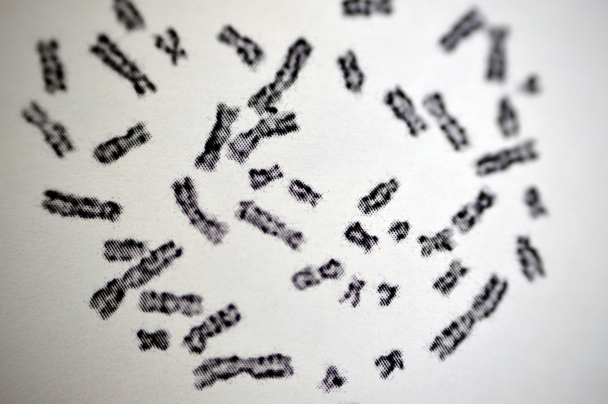 Normal female karyotyping
