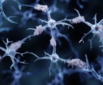 Protein Networks Expose New Therapeutic Targets for Alzheimer's