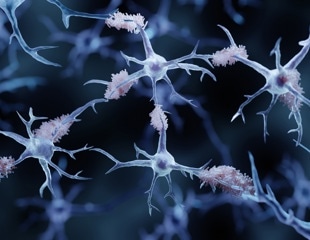 Protein Networks Expose New Therapeutic Targets for Alzheimer's