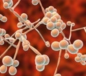 Scientists Discover Genetic Switch that Controls Candida's Toxin Production