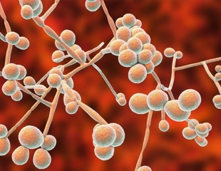 Scientists Discover Genetic Switch that Controls Candida's Toxin Production