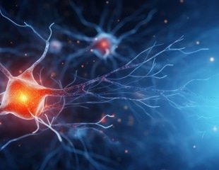 Thermo Fisher Scientific Expands Neurodegeneration Research Capabilities with Launch of Olink® Target 48 Neurodegeneration Panel