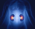 Human Kidney Organoids Offer New Insights into APOL1-Mediated Kidney Disease